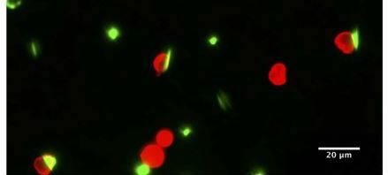A microscopic image of neutrophils